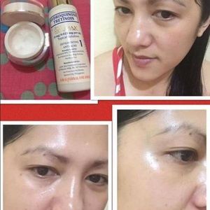 Dr. Alvin PSCF Rejumax 1 Whitening Acne Pimples